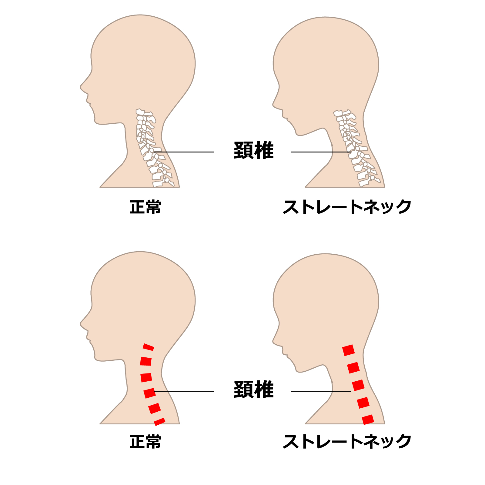 首 ストレッチ スマホ 【ストレートネックの治し方】首・肩の痛みは「スマホ首」が原因 ストレッチと生活習慣で改善可能