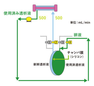 透析液の供給・交換図
